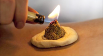 【艾灸知識(shí)】十大常見艾灸不良反應(yīng)，及處理方法！建議收藏！